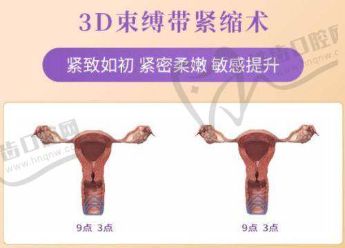 Motiva隆胸假体带芯片之增强信任纽带作用