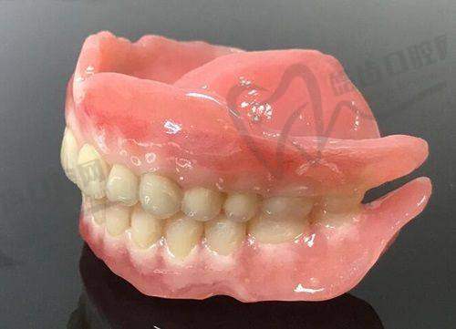 上海维乐口腔树脂活动义齿项目操作流程
