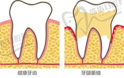 余姚冠杨口腔门诊部特色项目及技术优势
