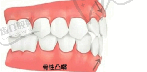 韶关星华口腔门诊部怎么样——医院地址与挂号指南