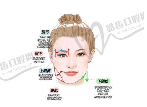 傲诺拉闪耀系列：低凸中凸高凸手感情况分析
