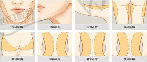 铂蕴假体隆胸价格——不同医院的价格情况