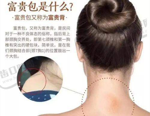 昆明拉雅医学美容门诊部怎么样，口碑评价如何？