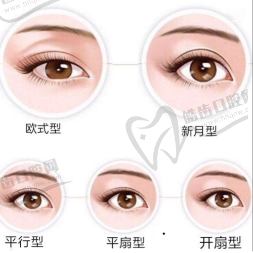 傲诺拉假体和曼托假体区别在哪之内部填充物不同