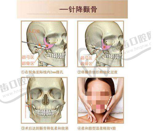 长春娅秘珠医疗美容连锁（活力城店）收费价格表/收费标准