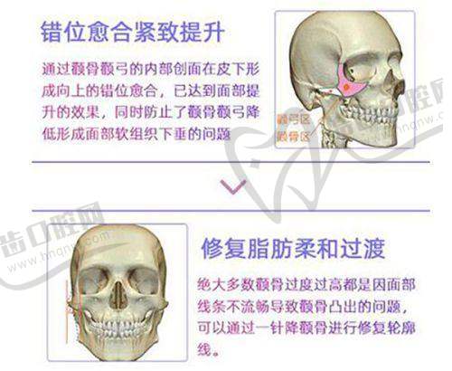 昆明悦莱医疗美容诊所怎么样，口碑评价如何
