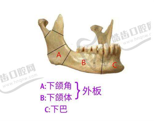 假体隆胸275cc刚手术后走路的情况说明