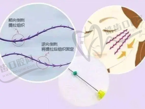 乌鲁木齐华茜医疗美容医院口碑好不好？附真实患者口碑评价