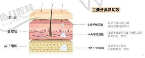 假体隆胸275cc的视觉成效与身材适配性探讨