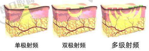 昆明悦莱医疗美容诊所地址及乘车路线