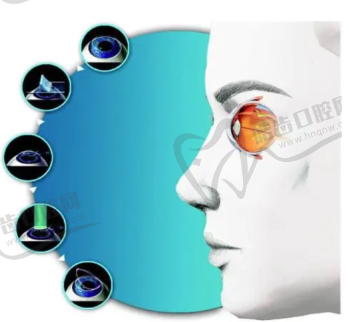 武汉佰视佳眼科韩国Lucid露晰得OK镜8500元起,青少年近视防控神器舒适又清晰