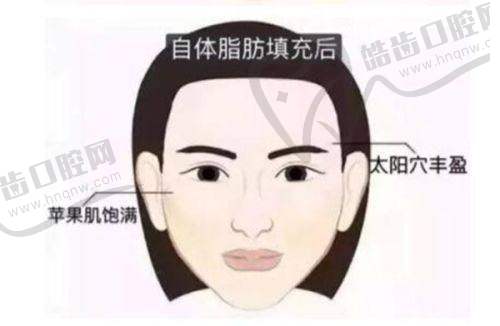 展现美国贝丽菲尔极纯胶原的显著优势