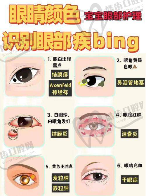 二、普瑞眼科医院是国有还是私立？性质详解