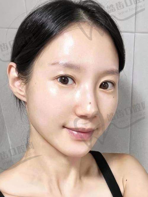 五、预约杨晓宁医生的“正确姿势”和术后养护Tips