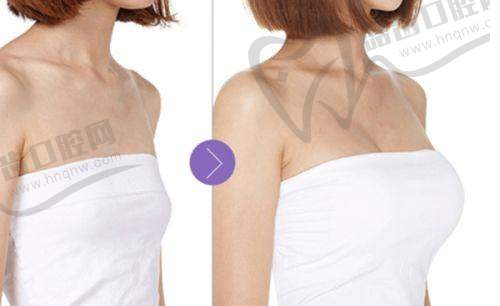 北京嘉禾妇儿医院侯智慧医生私密抗衰项目特色