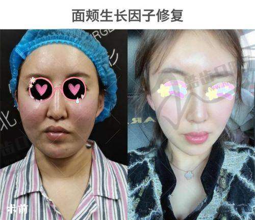 郑州美美整形美容医院价格表