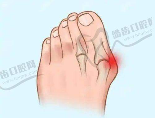 北京邱立东身体塑形做完的感觉如何?真人案例见证,术后颜值气质双提升超自信