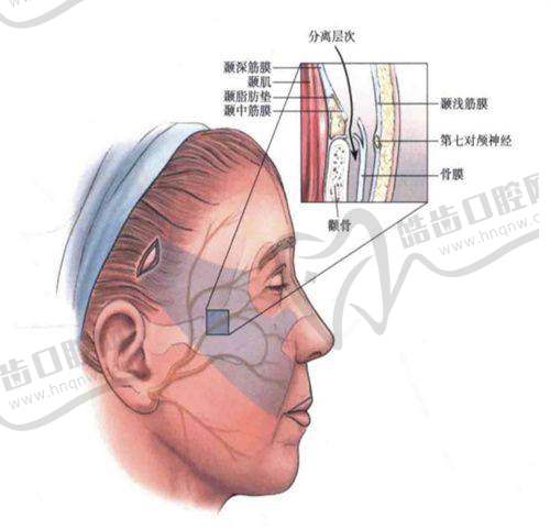陈郇医生的隆胸手术技术优势