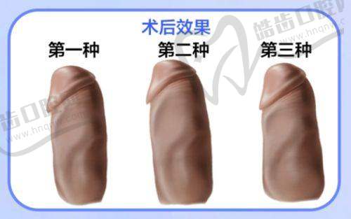 北京博士园医疗美容门诊部沈文誉医生整形项目特色展示
