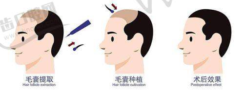 北京博士园毛发研究中 心的创建与发展历程