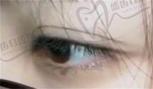 新疆石河子希望医院男女私密正规吗？