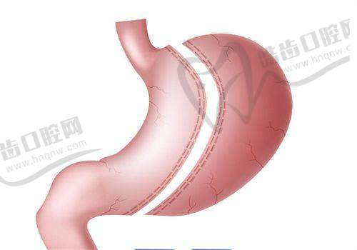 北京嘉禾医疗美容侯智慧医生阴蒂包皮术的优势体现