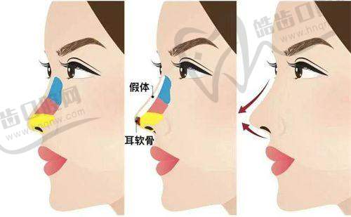 郑州安佳美容整形医院怎么样，口碑评价如何？