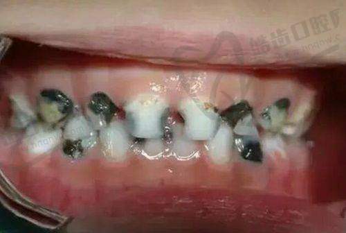 医生团队:专精与温暖并存