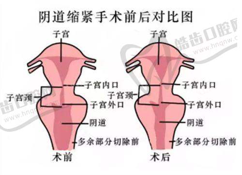 冯怜萍医生擅长的医疗美容项目