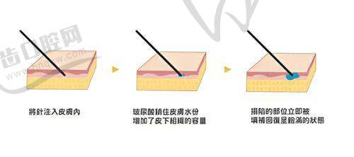新疆石河子希望医院男女私密价格表