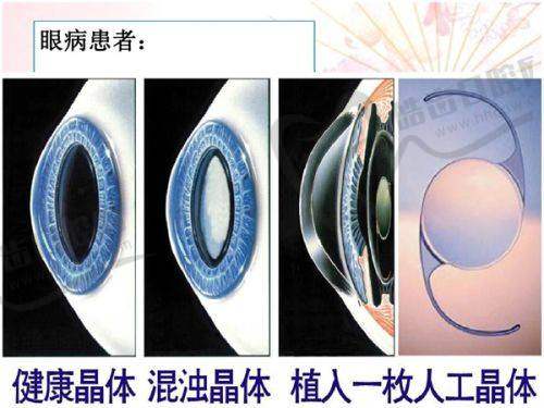 郑州芊美整形医院口碑好不好？附真实患者口碑评价
