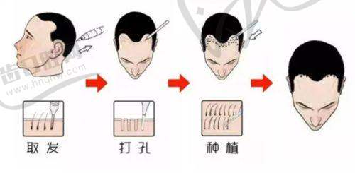北京碧莲盛袁国安医生技术水平究竟多高