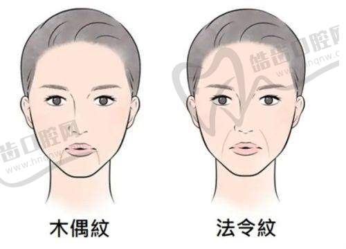陈乡南医生擅长的美容项目