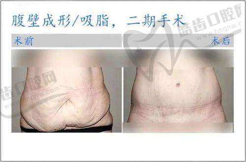郑州欧华医疗美容门诊部项目特色