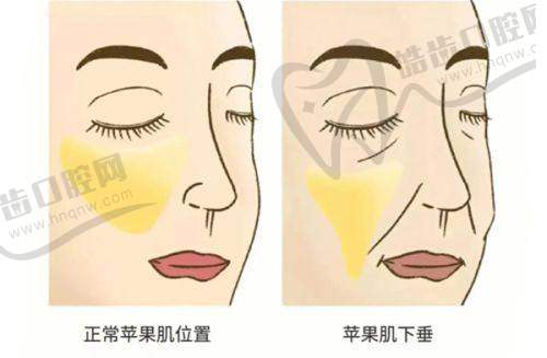 王和平医生的技术优势亮点