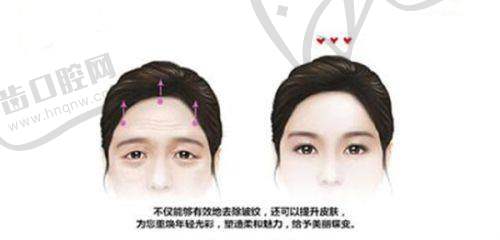 北京王怀劬医院合理的身体塑形手术价格