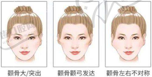 郑州芊美整形医院价格表