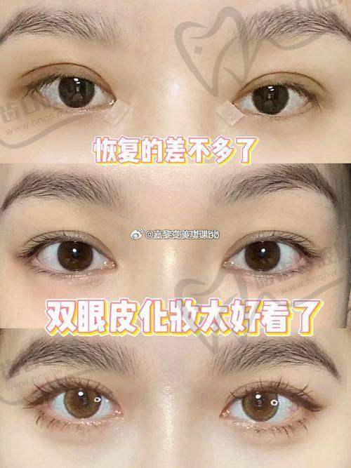 五、沈阳杏林王贵雄和杜继凤谁好？王贵雄偏“颌面”，杜继凤专“眼整形”