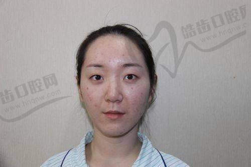 一、沈阳杏林杜继凤大夫怎么样？15年只做眼整形，把“自然”刻进每一刀里