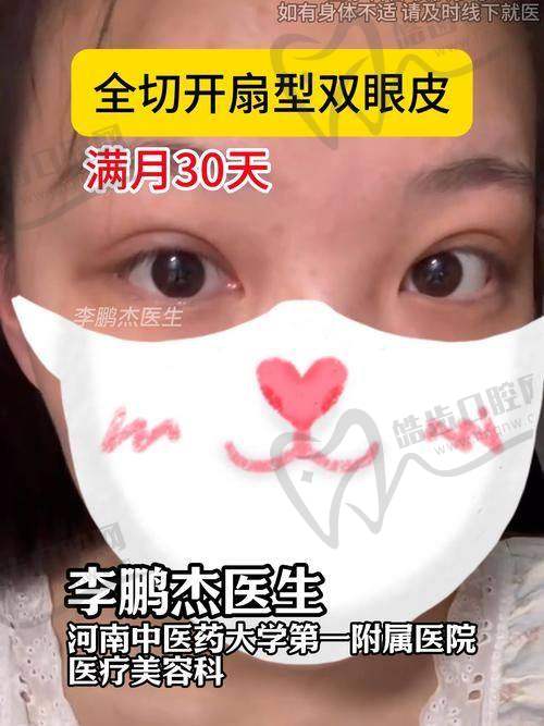 三、杜继凤眼部整形技术：微创、精细、个性化，打造“自然款”双眼皮
