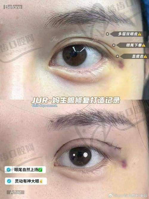 七、杜继凤预约指南：如何快速预约，避免排队