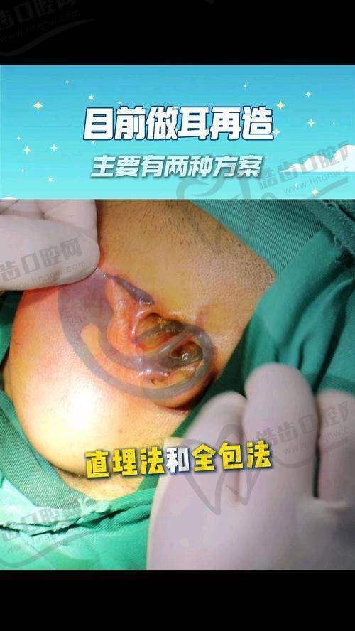 如何预约八大处的耳再造手术？