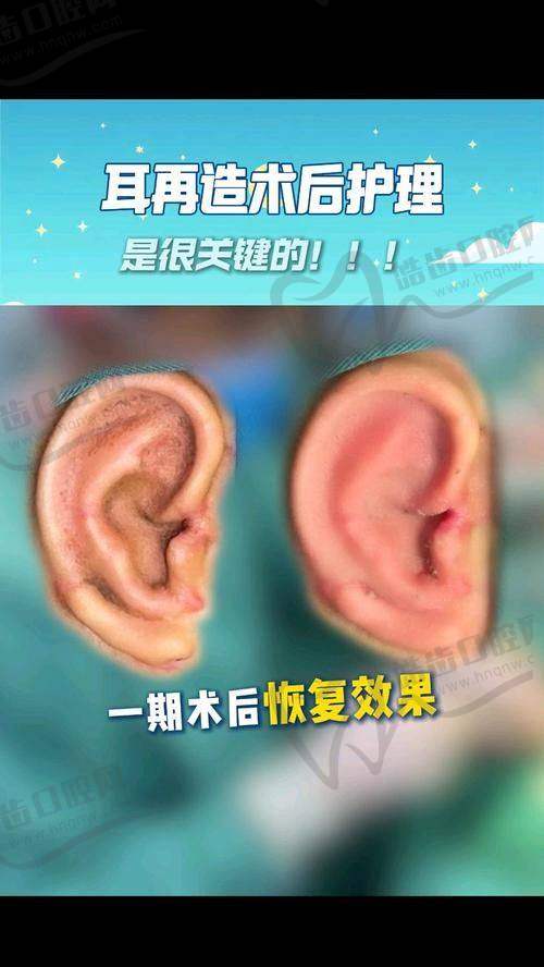 常见问题解答