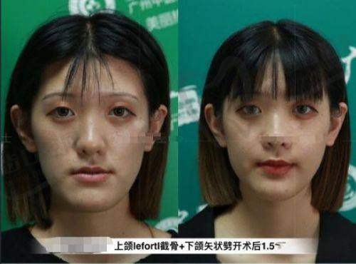 钟杰光医生医院的具体位置在广州白云区之选择优势