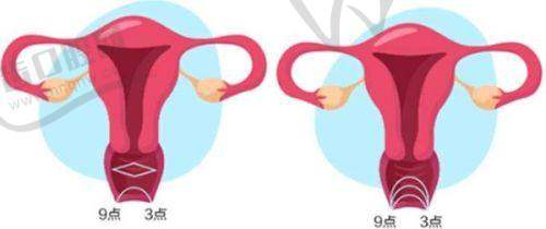 钟杰光医生做泪沟馒化修复手术的过程与体验