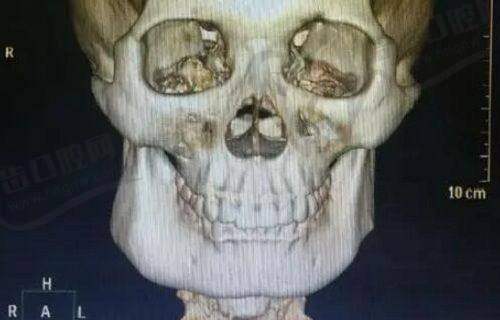 北京阎晓辉所在医院身体塑形临床实例成效怎样