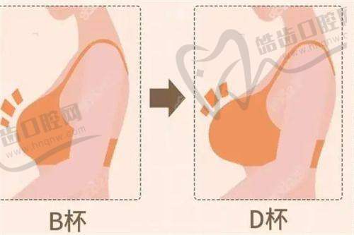 北京纯脂医疗美容门诊部术后反馈