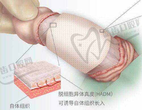北京高颖身体塑形项目：价格区间分析