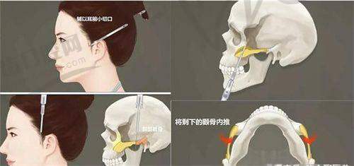 武汉欣悦整形美容医院怎么样？医院正规医生技术获好评，地址京汉大道499号