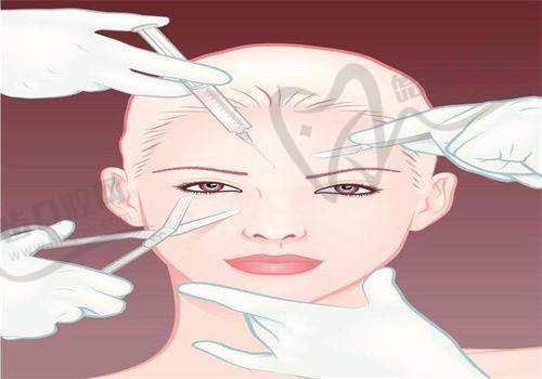 呂方中做雙眼皮到底怎么樣?——手術(shù)風格與成效